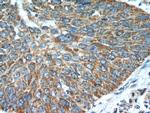 SHMT2 Antibody in Immunohistochemistry (Paraffin) (IHC (P))