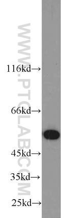 SHMT2 Antibody in Western Blot (WB)