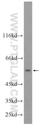 SHMT2 Antibody in Western Blot (WB)