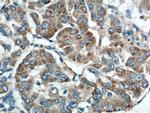 Rab23 Antibody in Immunohistochemistry (Paraffin) (IHC (P))