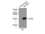 Rab23 Antibody in Immunoprecipitation (IP)