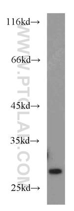 Rab23 Antibody in Western Blot (WB)