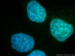 RANGAP1 Antibody in Immunocytochemistry (ICC/IF)