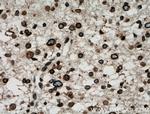 RANGAP1 Antibody in Immunohistochemistry (Paraffin) (IHC (P))