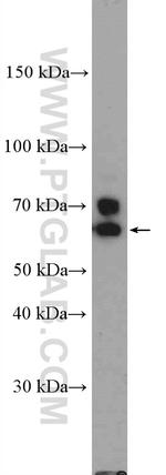 RANGAP1 Antibody in Western Blot (WB)