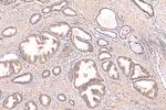 CUL3 Antibody in Immunohistochemistry (Paraffin) (IHC (P))