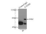 ETFDH Antibody in Immunoprecipitation (IP)