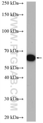 ETFDH Antibody in Western Blot (WB)