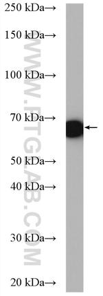 ETFDH Antibody in Western Blot (WB)