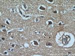 CYLD Antibody in Immunohistochemistry (Paraffin) (IHC (P))