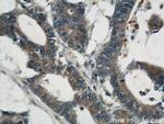 CYLD Antibody in Immunohistochemistry (Paraffin) (IHC (P))