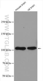 CYLD Antibody in Western Blot (WB)