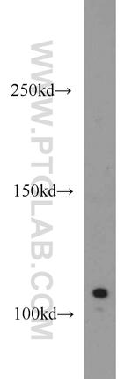 CYLD Antibody in Western Blot (WB)