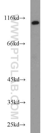 CYLD Antibody in Western Blot (WB)