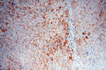 ACAA2 Antibody in Immunohistochemistry (Paraffin) (IHC (P))