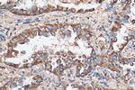 ACAA2 Antibody in Immunohistochemistry (Paraffin) (IHC (P))