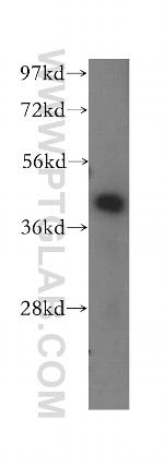 ACAA2 Antibody in Western Blot (WB)