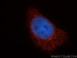 TAP1 Antibody in Immunocytochemistry (ICC/IF)