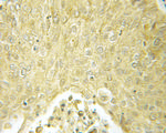 TAP1 Antibody in Immunohistochemistry (Paraffin) (IHC (P))