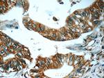 TAP1 Antibody in Immunohistochemistry (Paraffin) (IHC (P))