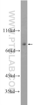 TAP1 Antibody in Western Blot (WB)