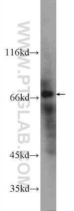 TAP1 Antibody in Western Blot (WB)