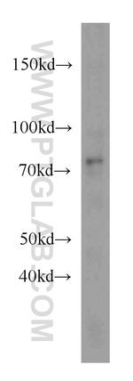 DDX3 Antibody in Western Blot (WB)