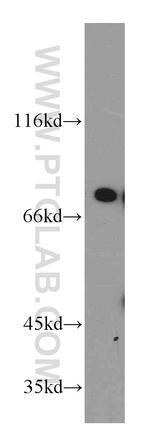 DDX3 Antibody in Western Blot (WB)