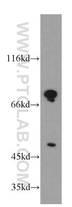 DDX3 Antibody in Western Blot (WB)