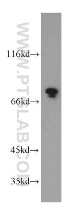 DDX3 Antibody in Western Blot (WB)