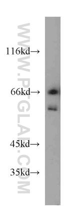 DDX3 Antibody in Western Blot (WB)