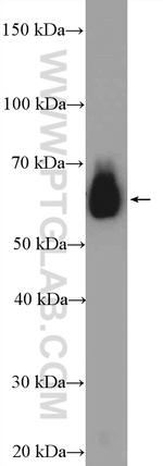 DDX3 Antibody in Western Blot (WB)