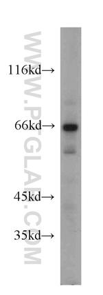 DDX3 Antibody in Western Blot (WB)