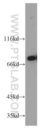 DDX3 Antibody in Western Blot (WB)