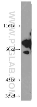 DDX3 Antibody in Western Blot (WB)