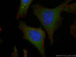 TXNRD1 Antibody in Immunocytochemistry (ICC/IF)