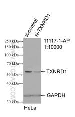 TXNRD1 Antibody in Western Blot (WB)