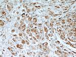 TXNRD1 Antibody in Immunohistochemistry (Paraffin) (IHC (P))