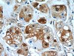 TXNRD1 Antibody in Immunohistochemistry (Paraffin) (IHC (P))