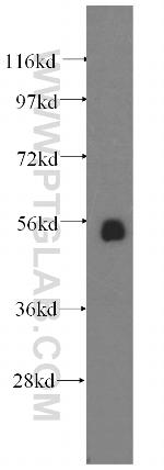 TXNRD1 Antibody in Western Blot (WB)