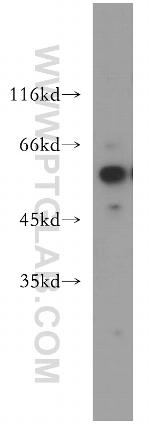 TXNRD1 Antibody in Western Blot (WB)