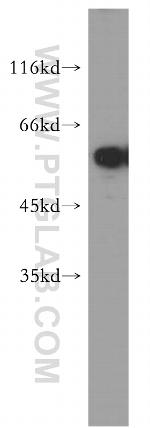 TXNRD1 Antibody in Western Blot (WB)