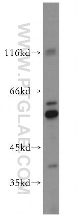 TXNRD1 Antibody in Western Blot (WB)