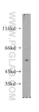 TXNRD1 Antibody in Western Blot (WB)