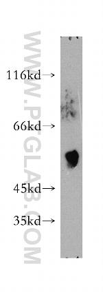 TXNRD1 Antibody in Western Blot (WB)