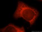 TXNRD1 Antibody in Immunocytochemistry (ICC/IF)