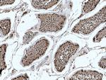 TXNRD1 Antibody in Immunohistochemistry (Paraffin) (IHC (P))