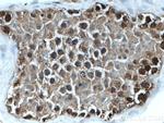 TXNRD1 Antibody in Immunohistochemistry (Paraffin) (IHC (P))