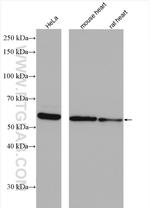 TXNRD1 Antibody in Western Blot (WB)