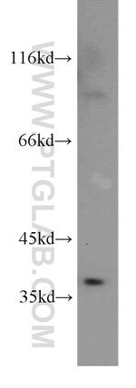 MEST Antibody in Western Blot (WB)